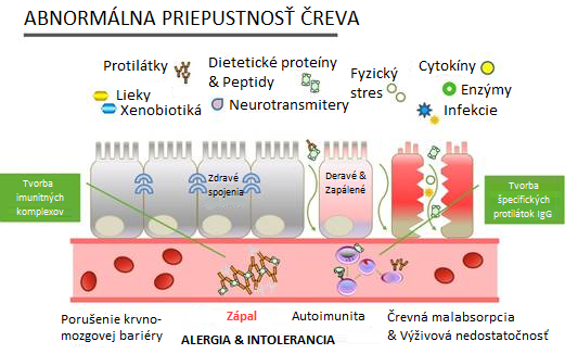 Obr. 2: Abnormálna priepustnosť čreva