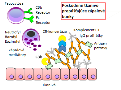 Obr. 3: Poškodené tkanivo prepúšťajúce zápalové bunky